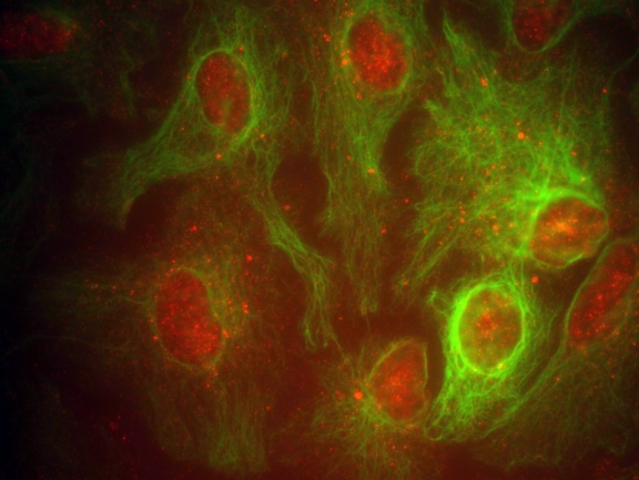 astrocytes