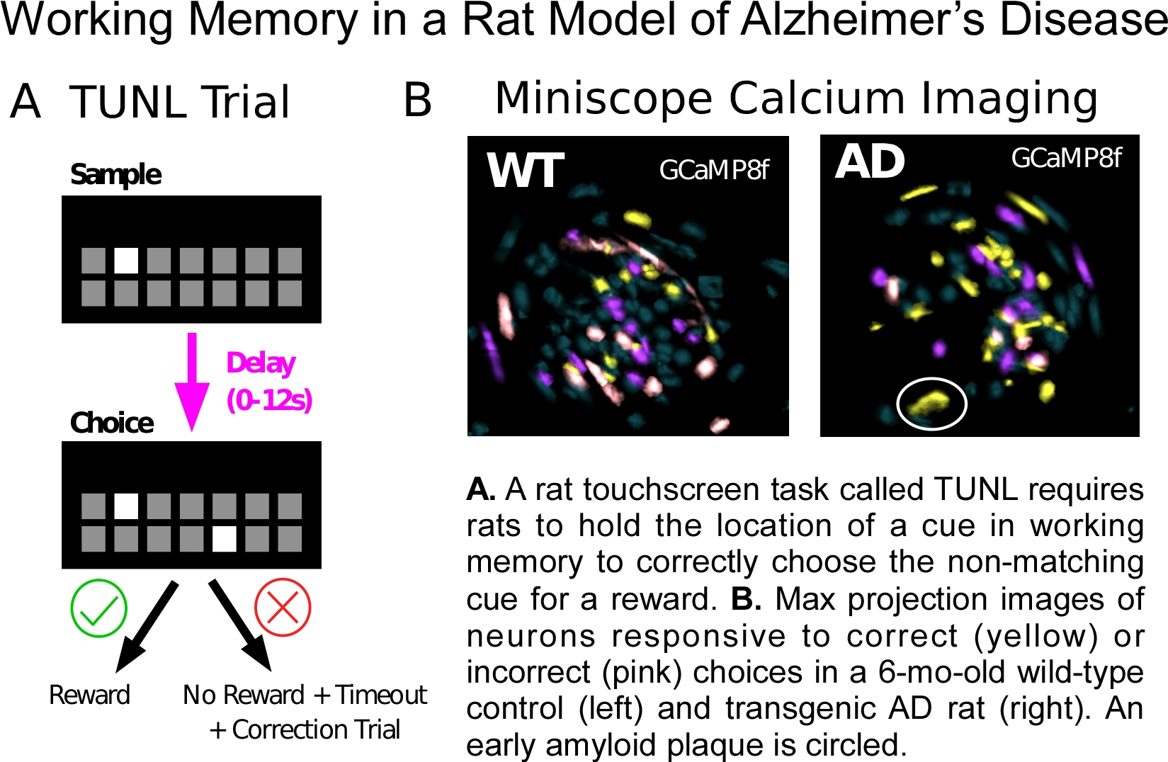 Brain activity during working memory in an Alzheimer's rat model Image shows expression of a calcium indicator in prefrontal neurons